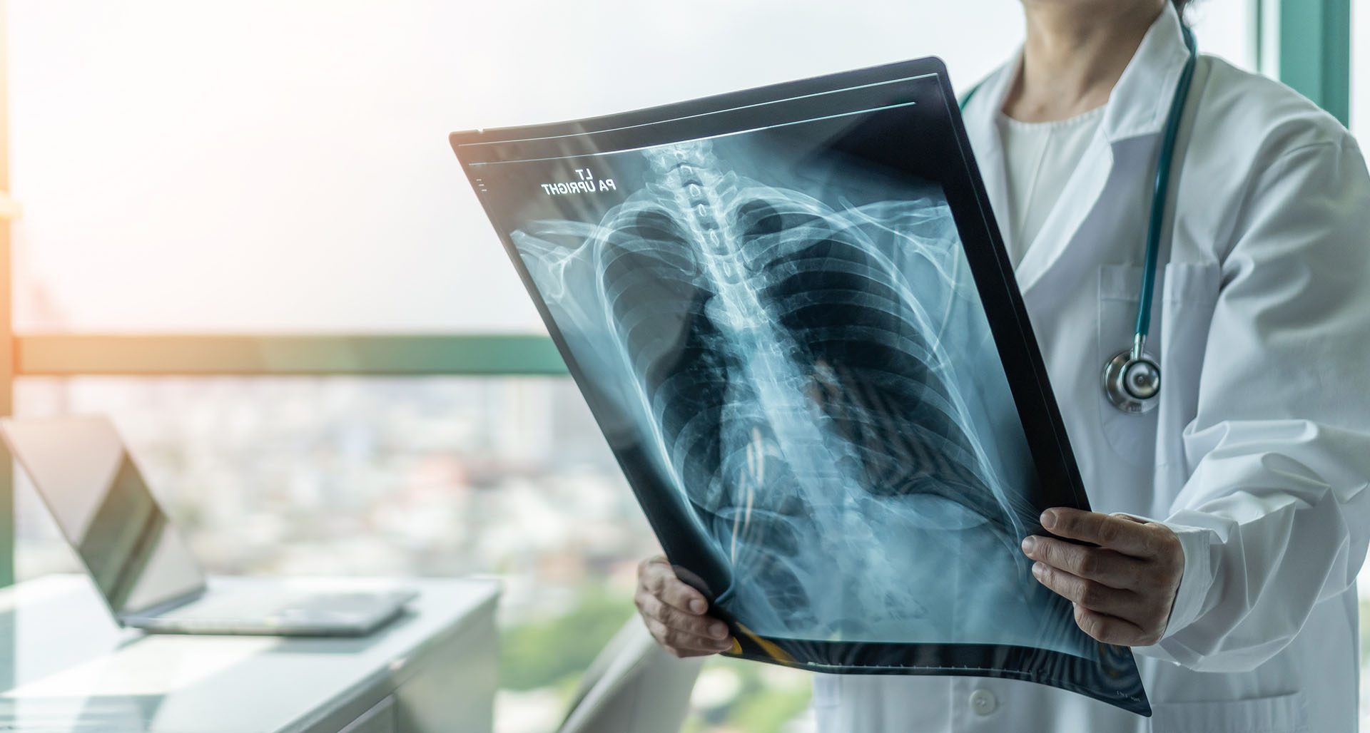 bg-radiología-mamografia